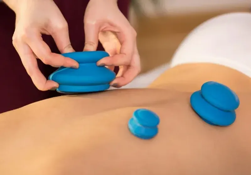 Cupping therapy applied to a patient during a recovery session