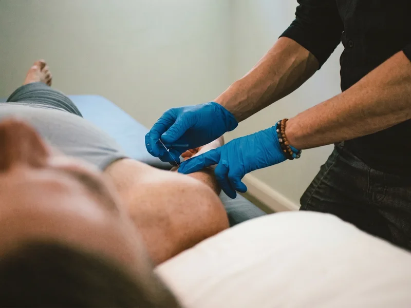 Clinician performing dry needling on a patient's chest